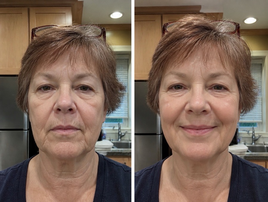 Nancy P. before and after