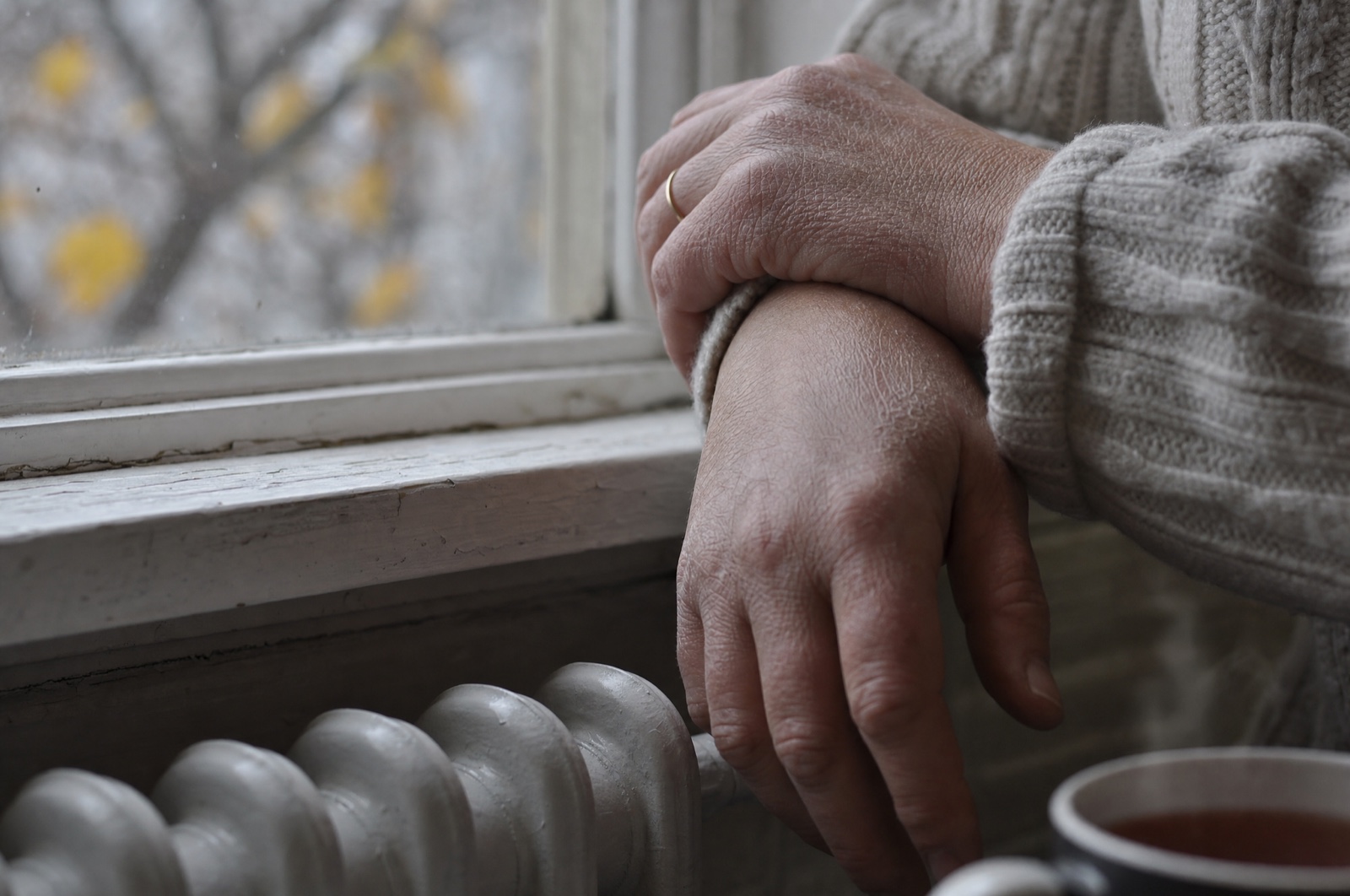 Dry, rough skin on the back of a woman's hands resting on a windowsill next to a radiator