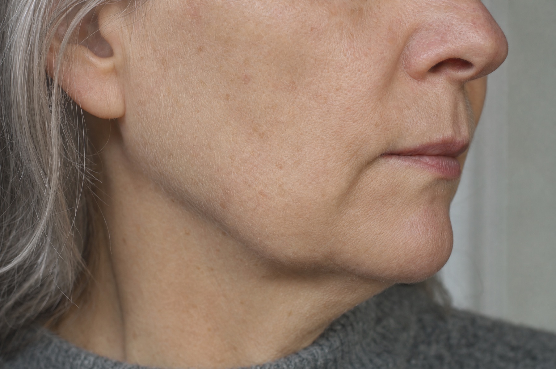 Close-up of the cheek and jawline of a woman in her early sixties in flat window light with natural skin texture and fine lines